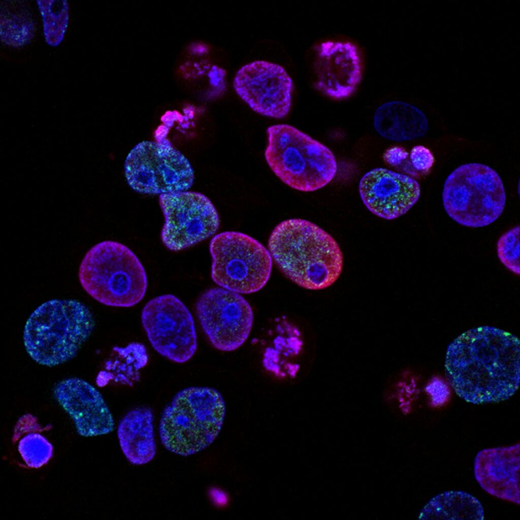 Autophagy, explained without the jargon